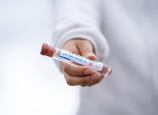 Coronavirus, in Toscana 26 nuovi casi di cui 14 relativi a rientri dall’estero