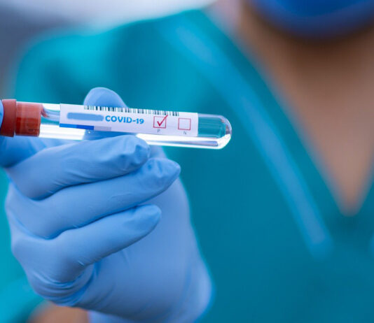 Coronavirus, in Toscana 73 casi in più rispetto a ieri e nessun decesso