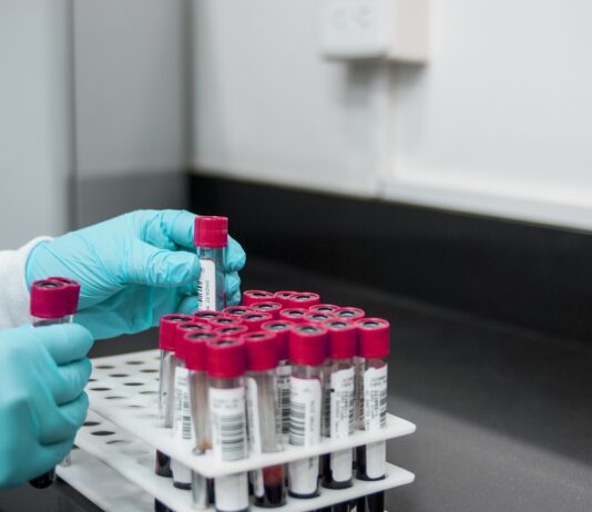 Coronavirus, 4 nuovi casi nell’aretino. Tre di ritorno da Corfù e uno dalla Romania