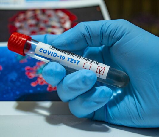 Coronavirus: in Toscana 866 nuovi casi, età media 44 anni, 13 decessi