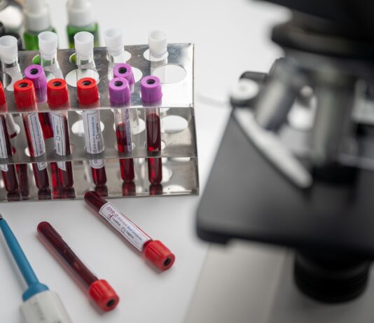 Coronavirus: 53 nuovi casi nell’aretino, 14 persone in degenza covid e 2 in terapia intensiva
