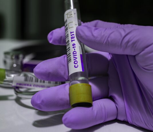 Coronavirus: 33 nuovi casi nell’aretino, 11 persone in degenza covid