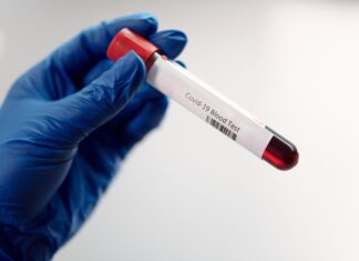 Coronavirus Toscana, 875 nuovi casi, 4 i decessi età media 85 anni