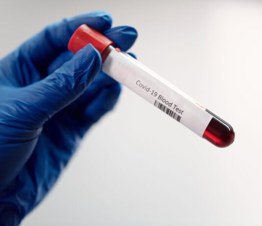 Coronavirus: in Toscana 1.883 nuovi casi e 10 decessi