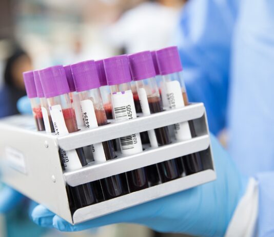 Coronavirus Toscana, 1.229 nuovi casi Due i decessi di 93 anni