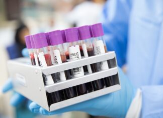 Coronavirus Toscana, 275 nuovi casi e un decesso